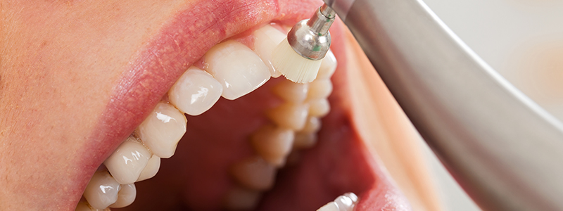 歯周病を予防するために必要なこと
